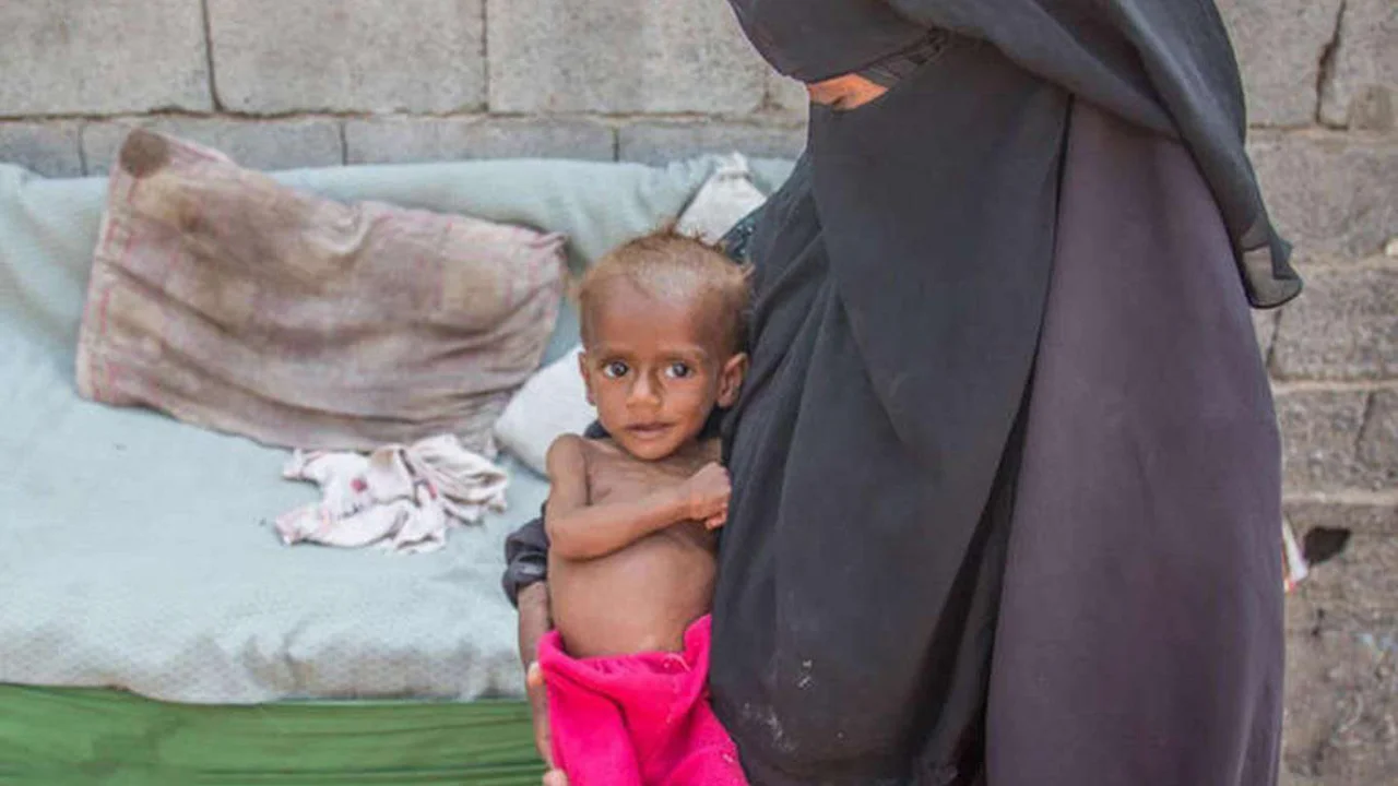 Yemen'de çocuklar açlığın pençesinde